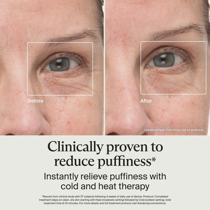 Depuffing Wand Cold and Heat Skincare Treatment to Depuff and Glow Beauty Wand, Face Roller and Eye Massager for Eye Puffiness,