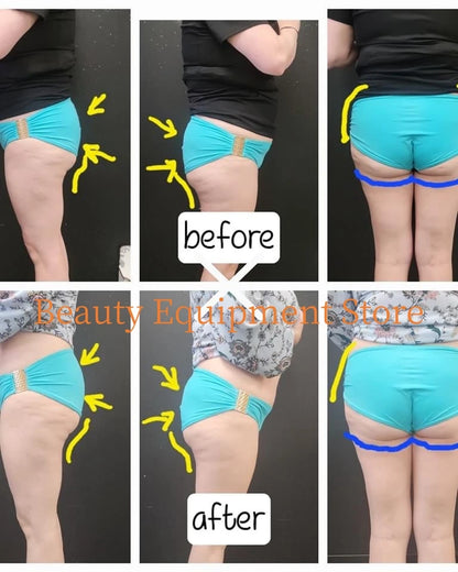 EMS MYOslim EMS Body Slimming Machine Body Scultping Shaping Muscle Machine Electromagnetic Weight Loss Beauty Salon