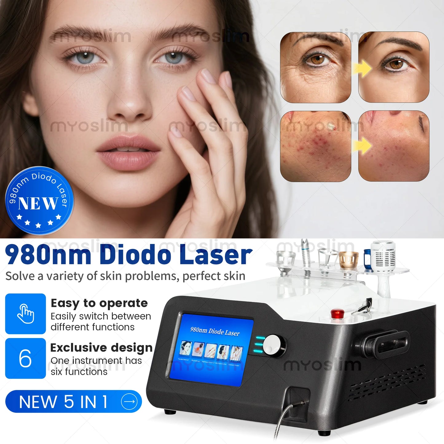 5 In 1 980nm Diode Laser Machine Nail Fungus Treatment Spider Veins Vascular Removal Skin Rejuvenation Beauty Device